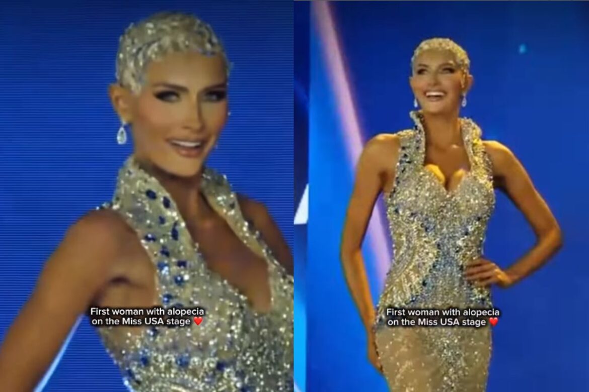 video:-modelo-com-alopecia-tira-a-peruca-durante-concurso-de-beleza
