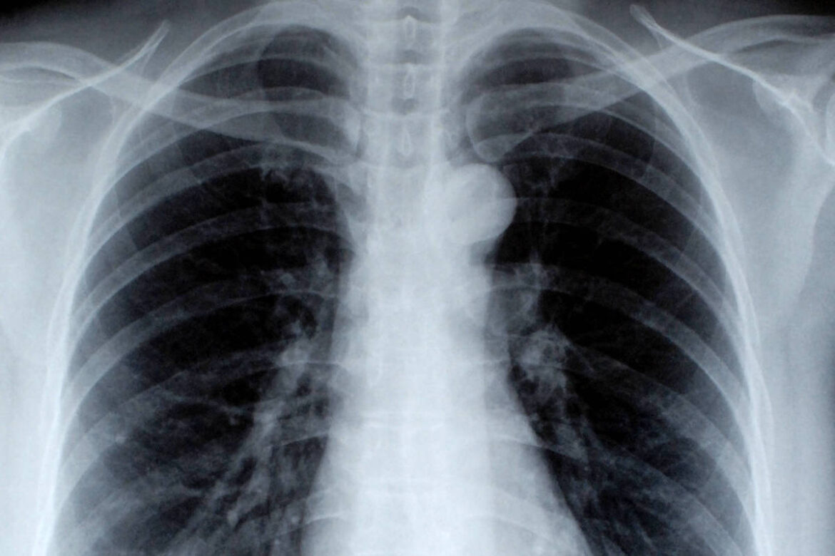 medo-de-efeitos-da-radiacao-afasta-medicas-mulheres-de-especialidades