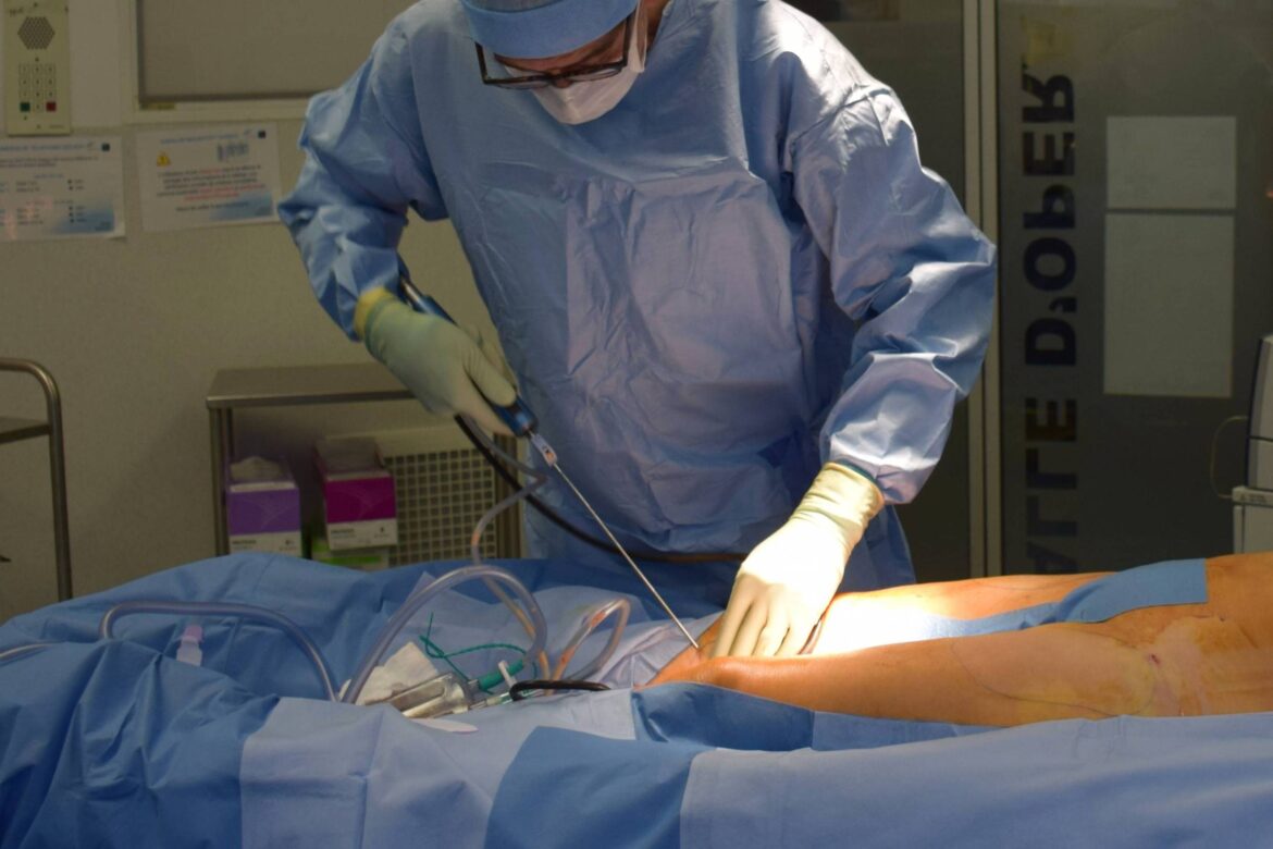 lipoaspiracao-e-a-cirurgia-plastica-mais-realizada-no-brasil