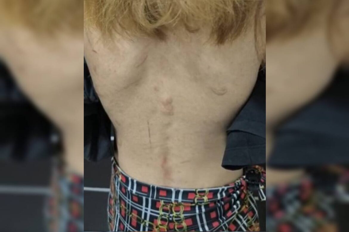 trisal-e-denunciado-por-tortura-apos-jovem-de-16-anos-fugir-de-carcere