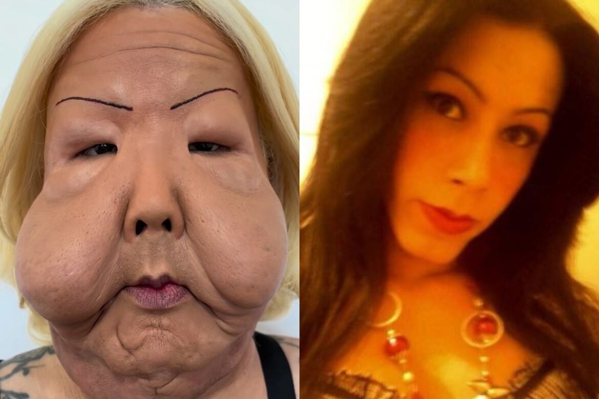 conheca-juju-do-pix,-influenciadora-que-passa-por-reconstrucao-facial