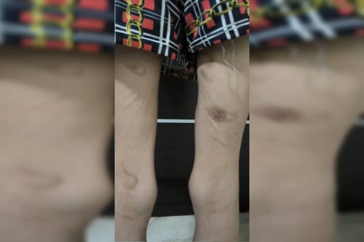 carcere:-jovem-agredida-por-trisal-em-goias-estava-muito-debilitada