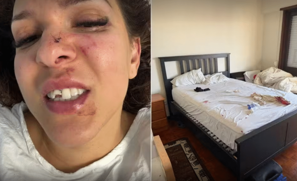 video:-brasileira-diz-que-marido-fugiu-para-o-brasil-apos-agredi-la-em-portugal