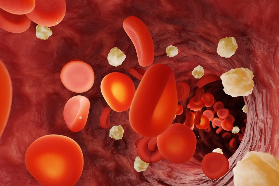 nutricionista-ensina-como-controlar-a-glicose-nas-festas-de-fim-de-ano