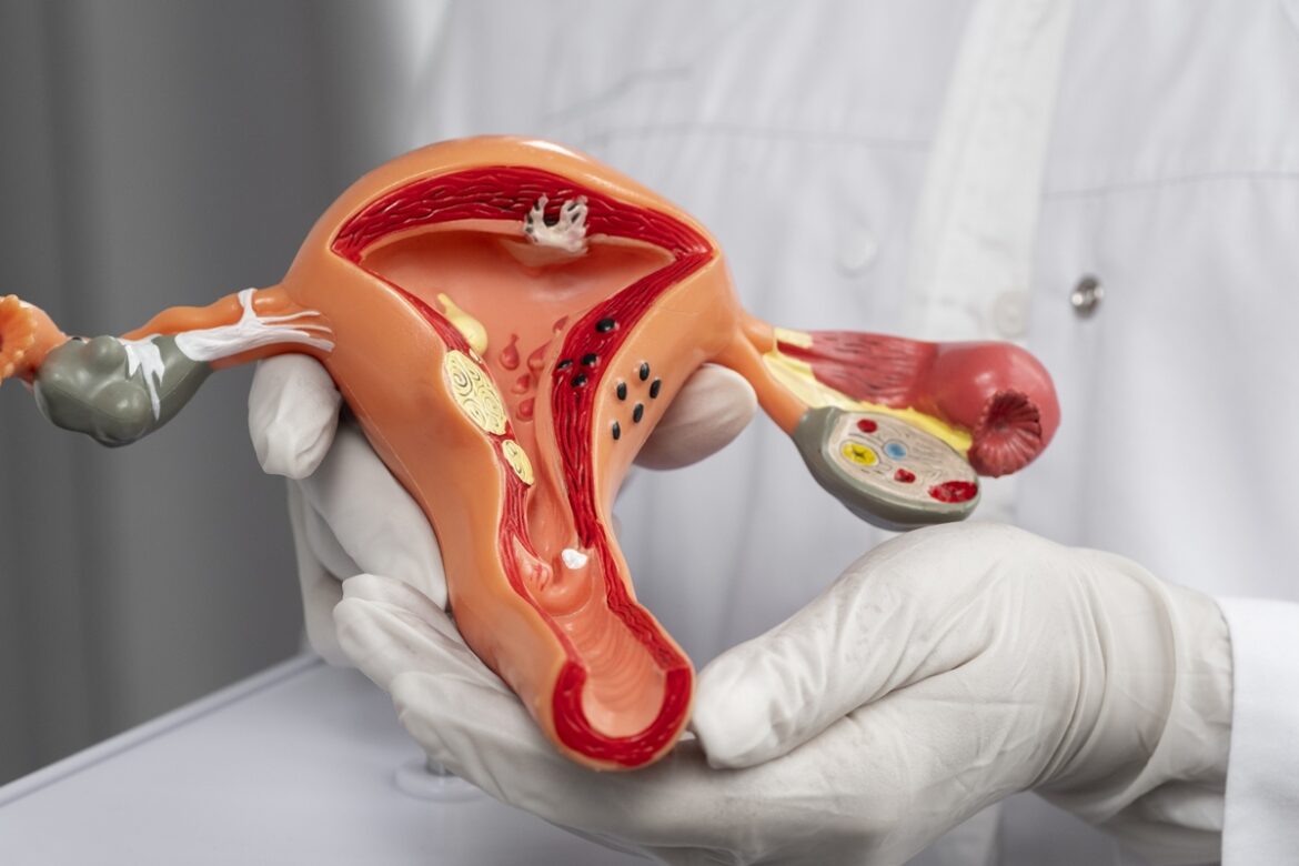 oncologistas-explicam-se-mau-cheiro-nos-genitais-pode-indicar-cancer